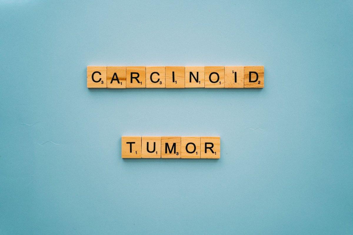 Carcinome basocellulaire : reconnaître les signes sur photo et agir