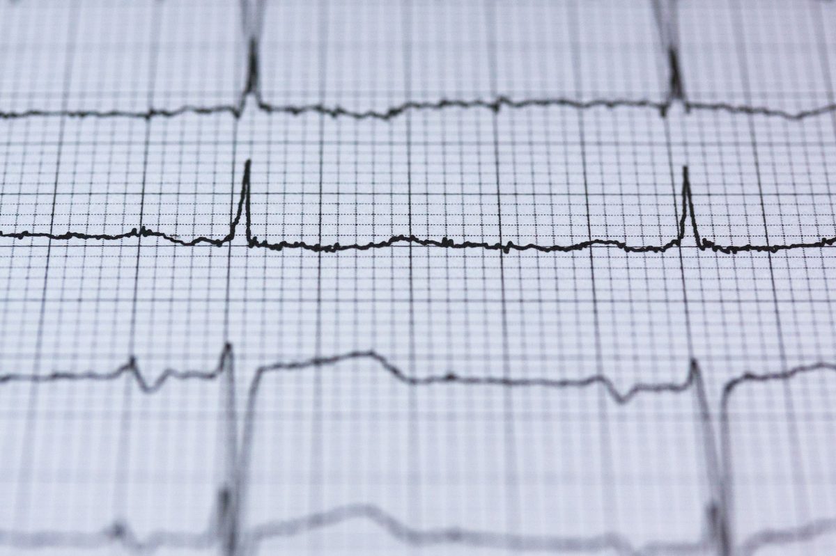 Fréquence cardiaque normale du nouveau-né à l'enfant