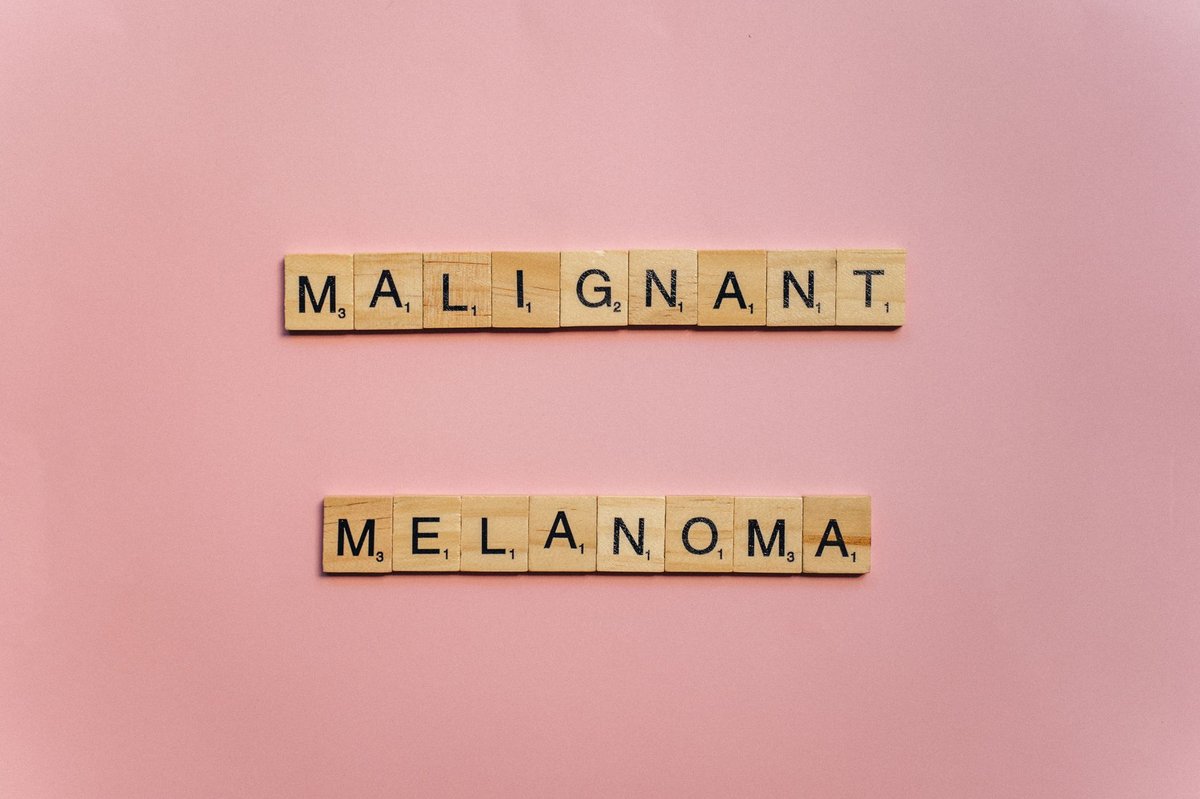 Grain de beauté ou mélanome : 5 signes pour différencier